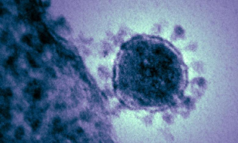 الجزائر تسجّل أول إصابة مؤكدة بفيروس كورونا -كورونا-6-780x470